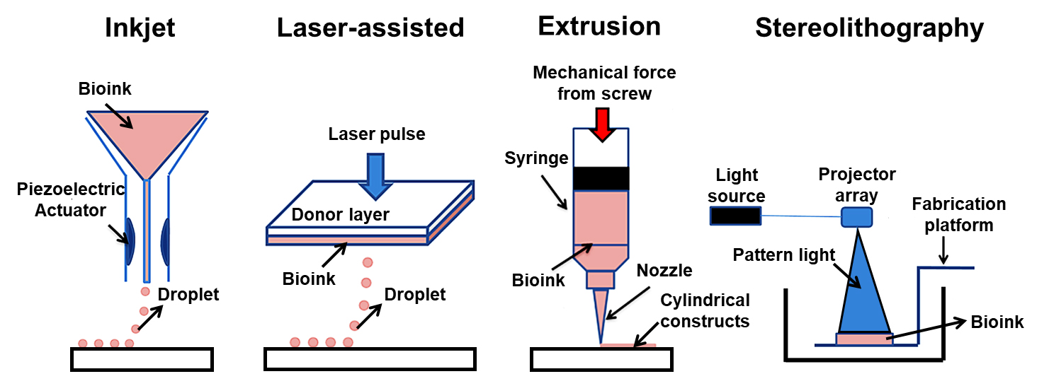 Clinical Perspectives on 3D Bioprinting Paradigms for Regenerative Medicine
